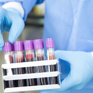 Exheus, la start-up catalana que busca mejorar la salud con muestras de sangre