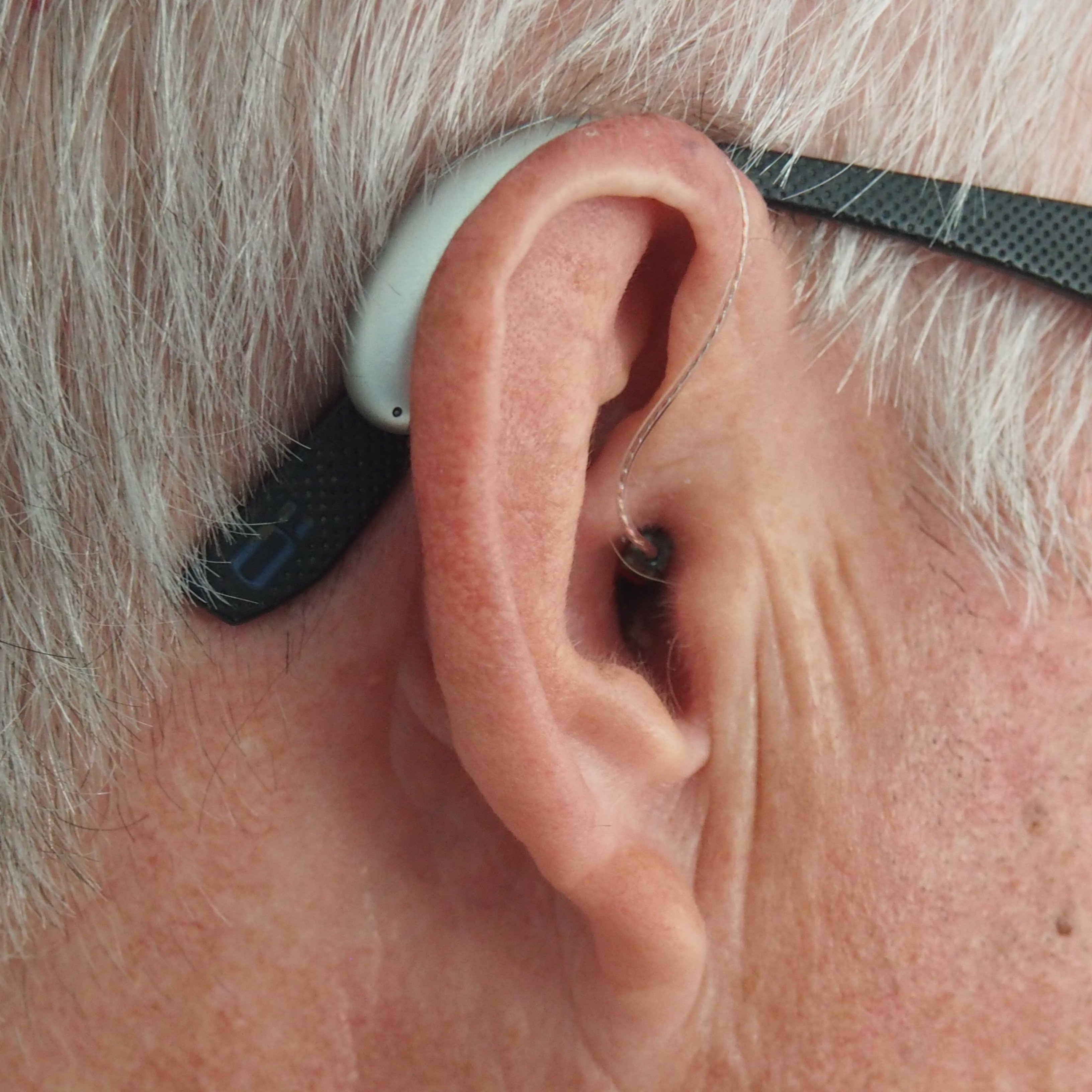 Encuentran una relación entre la pérdida auditiva y la demencia