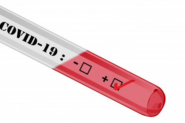 Test COVID 19