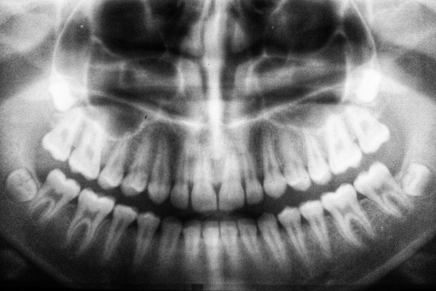 radiografia boca unsplash