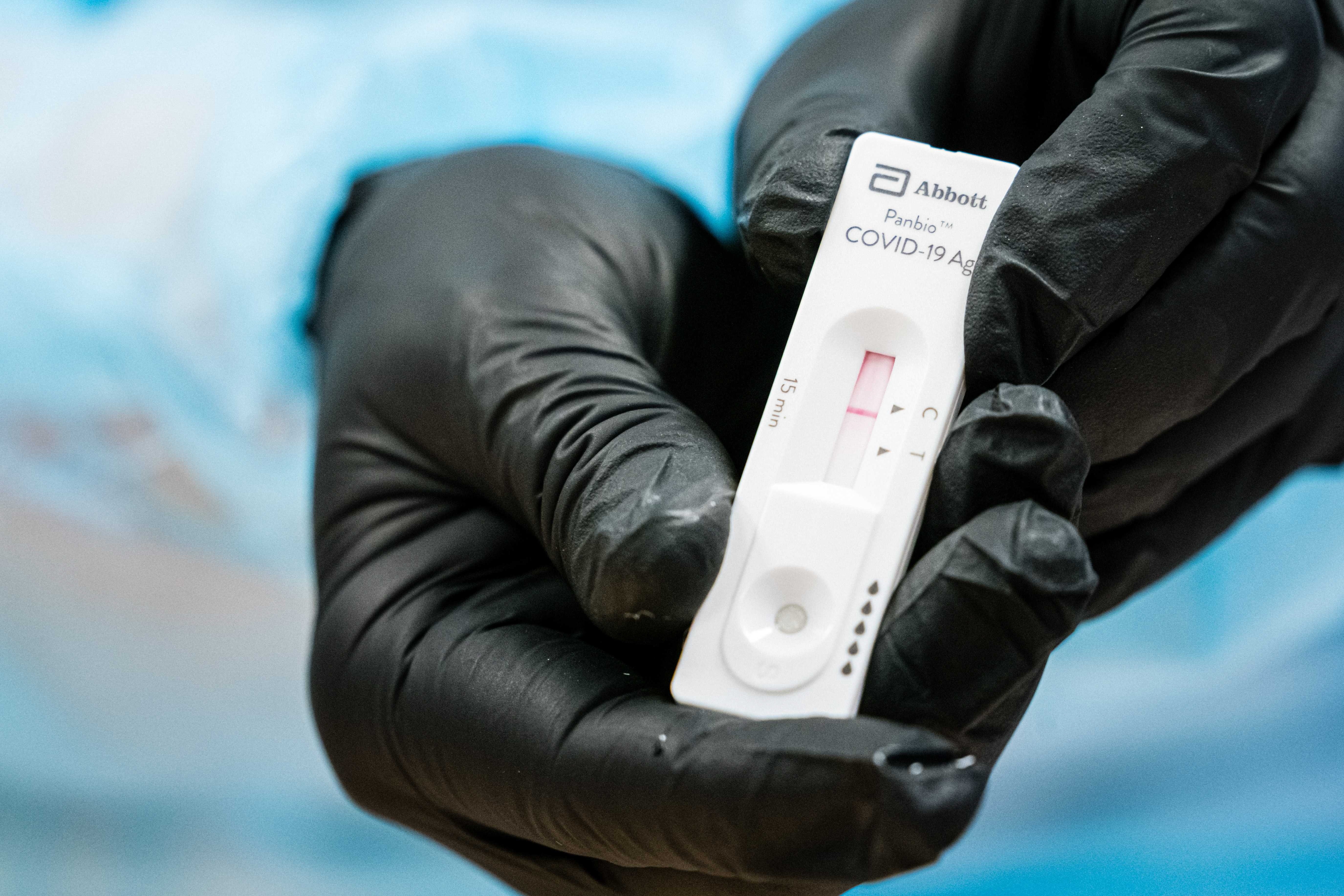 El test ràpid que faran servir 133 països per detectar casos de coronavirus