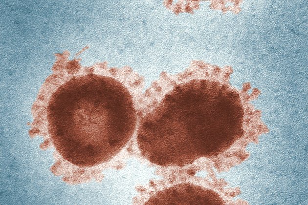 coronavirus cell unsplash