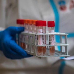 laboratori test proves coronavirus EFE