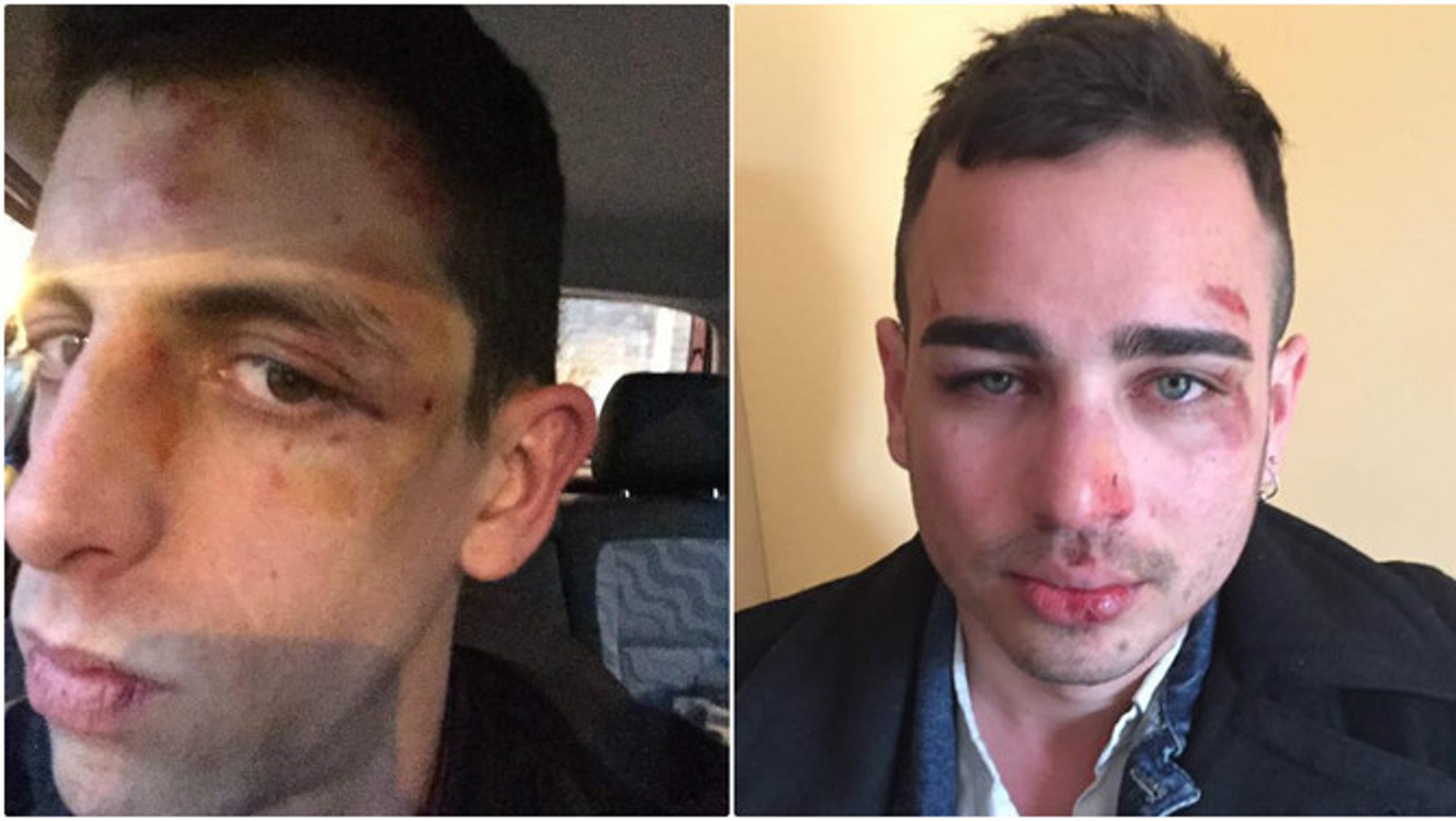 Identificado uno de los autores de la agresión homófoba en Berga