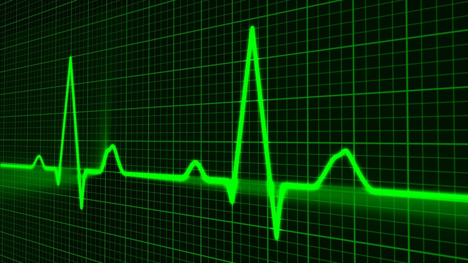 Electrocardiograma