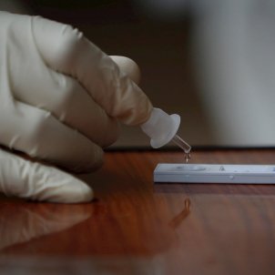 test coronavirus EFE test coronavirus EFE