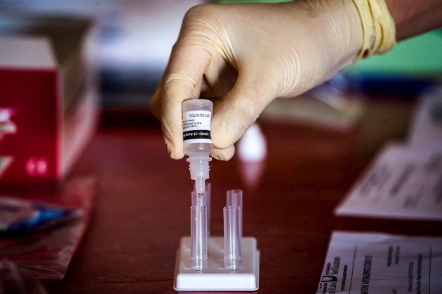 prova test antígens coronavirus EFE
