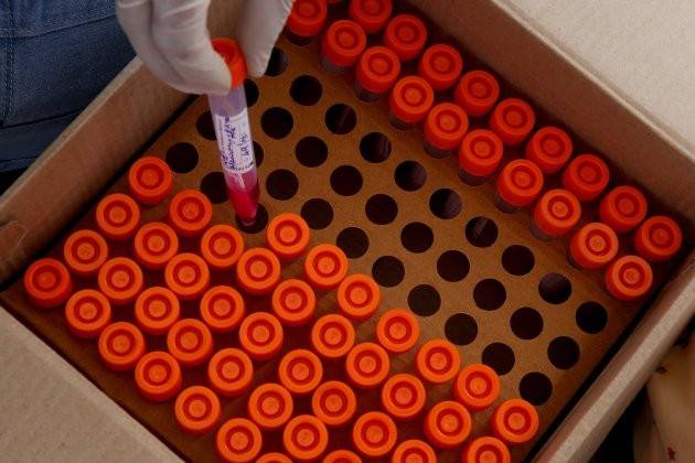 coronavirus efe test