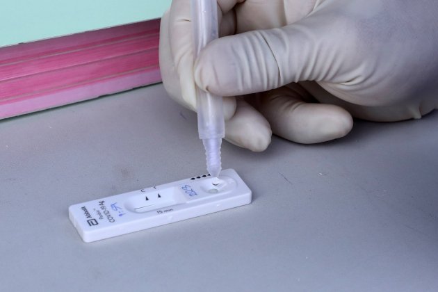 test rapid d'antigen coronavirus efe