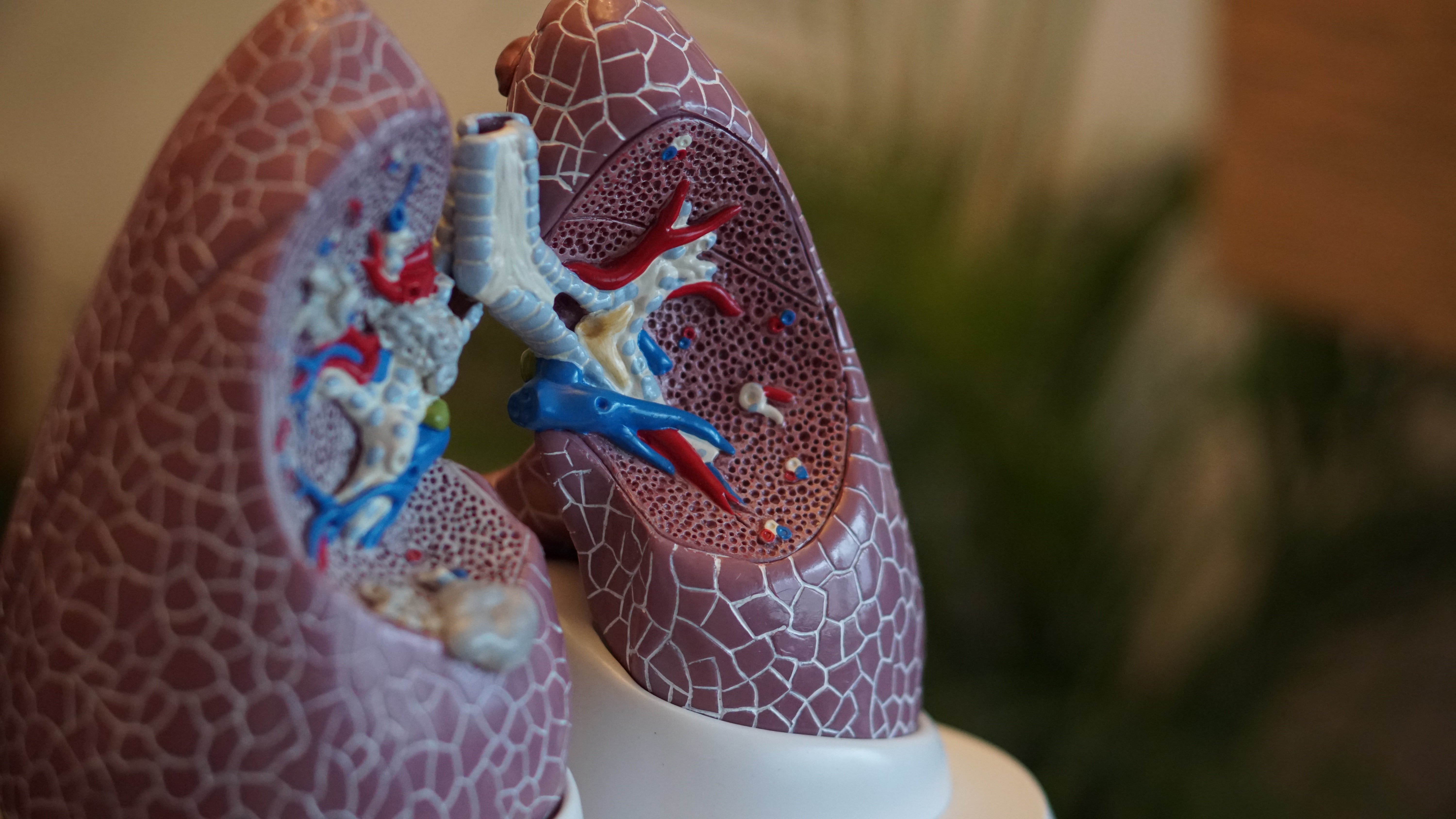 Pacientes poscovid podrían sufrir daños pulmonares tres meses después