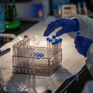 test coronavirus efe test coronavirus efe