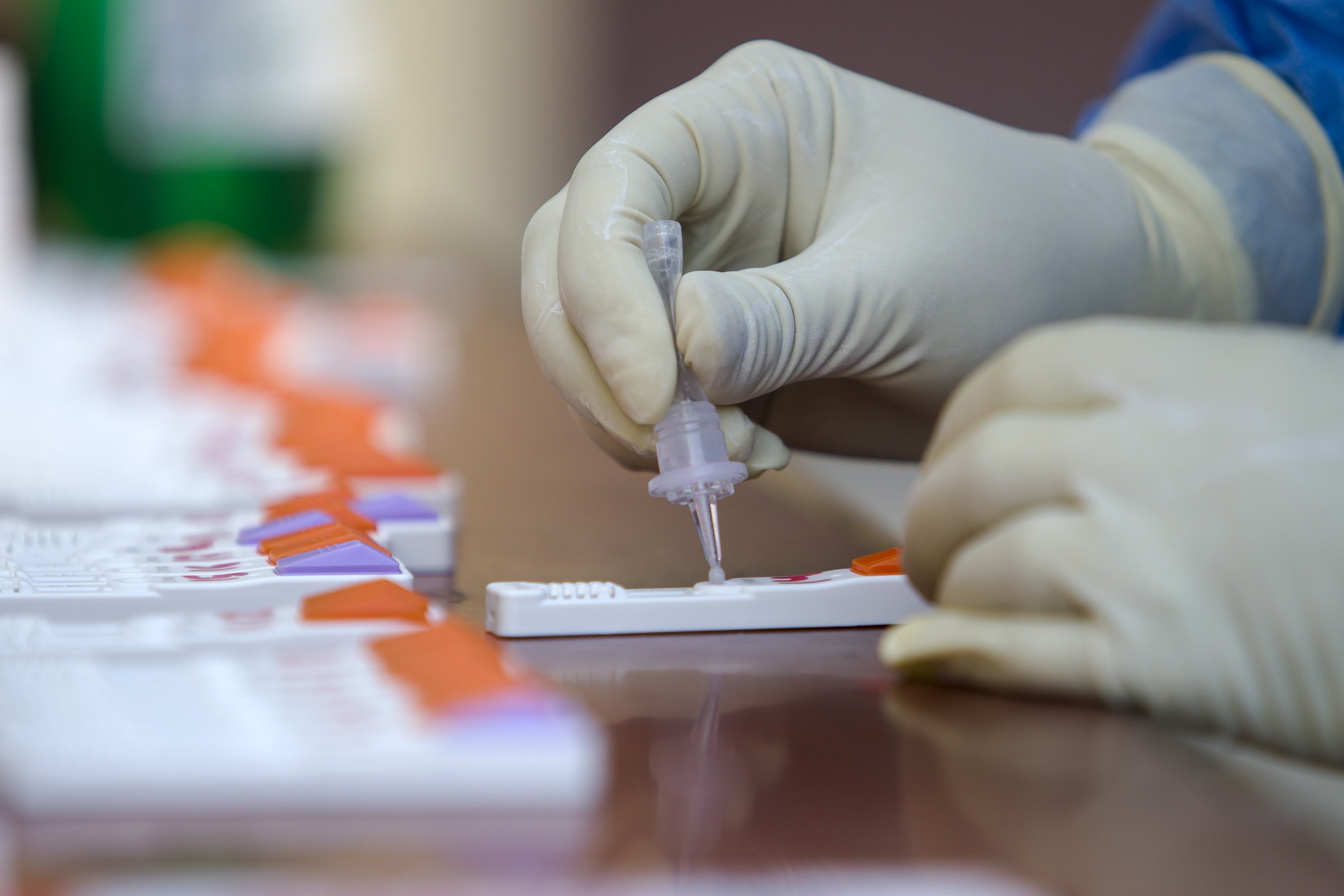 Sanidad desaconseja a los médicos prescribir test de autodiagnóstico de Covid