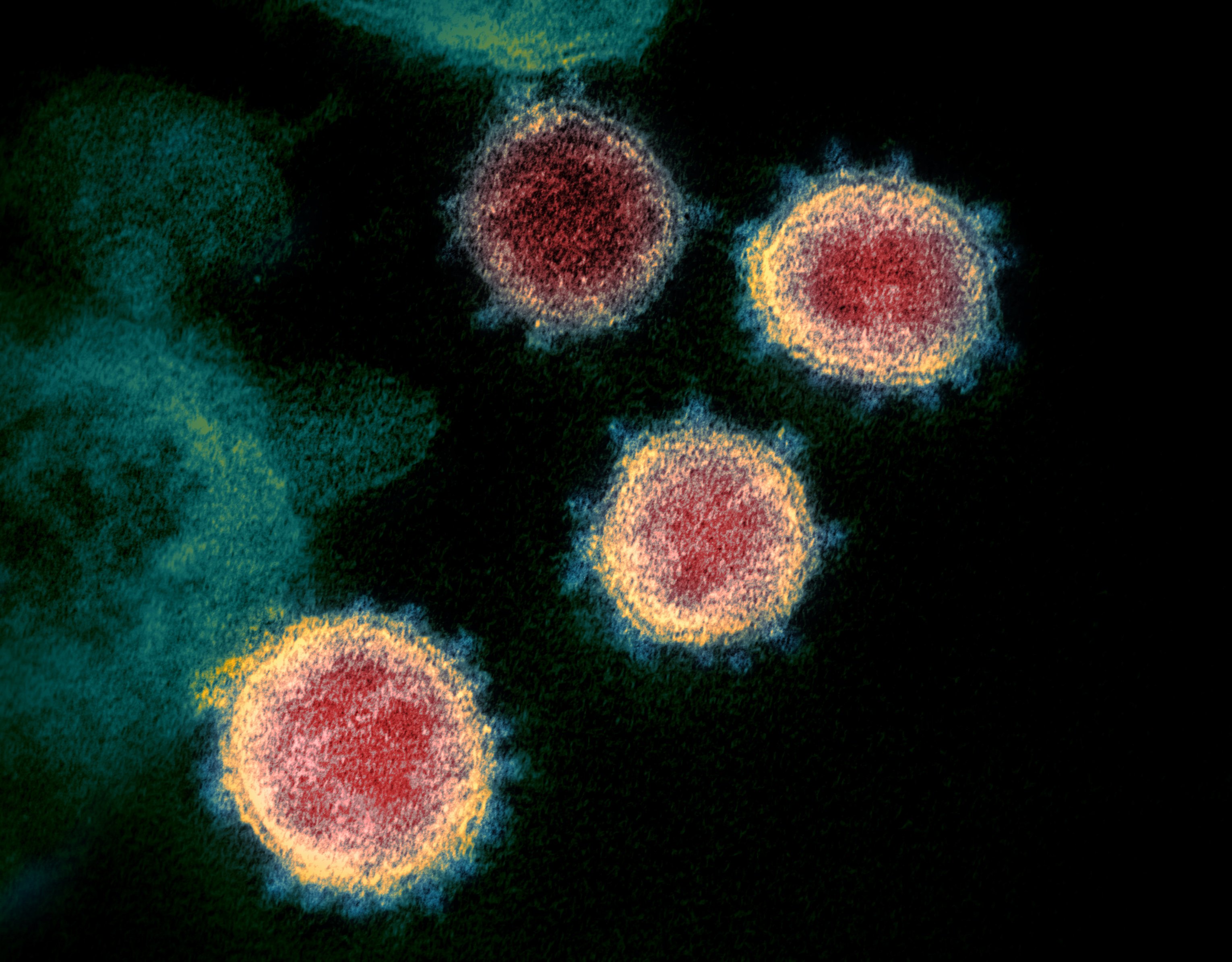 El coronavirus, condemnat a sobreviure: es podria convertir en refredat