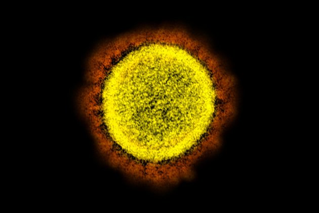 coronavirus celula molecula niaid flickr