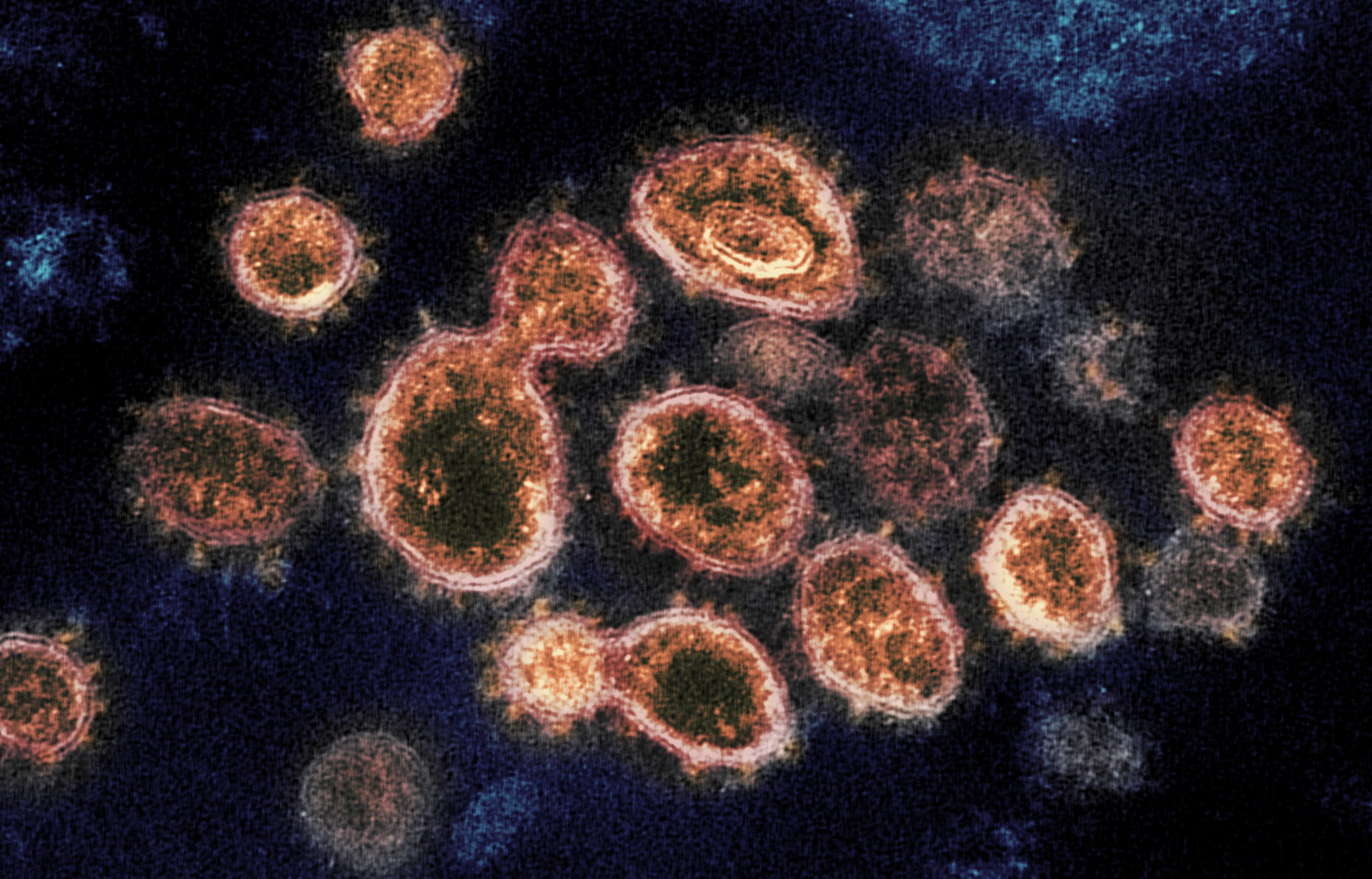Aquestes són les variants de coronavirus que circulen pel món