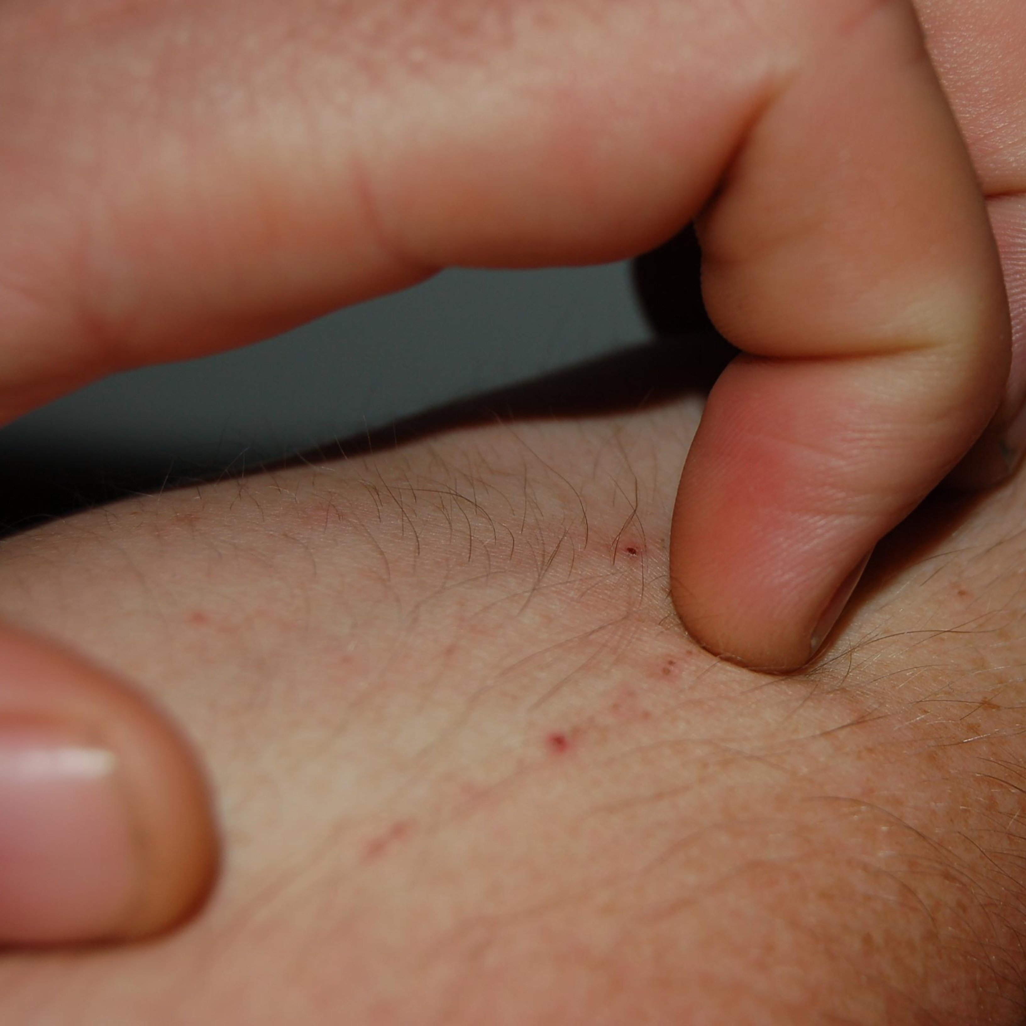 El excesivo control de calidad de los alimentos provoca alergias alimentarias