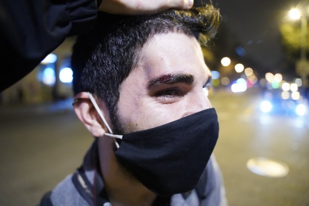  Periodista Sergi Rodergas herido manifestación Hasél / Pau de la Calle
