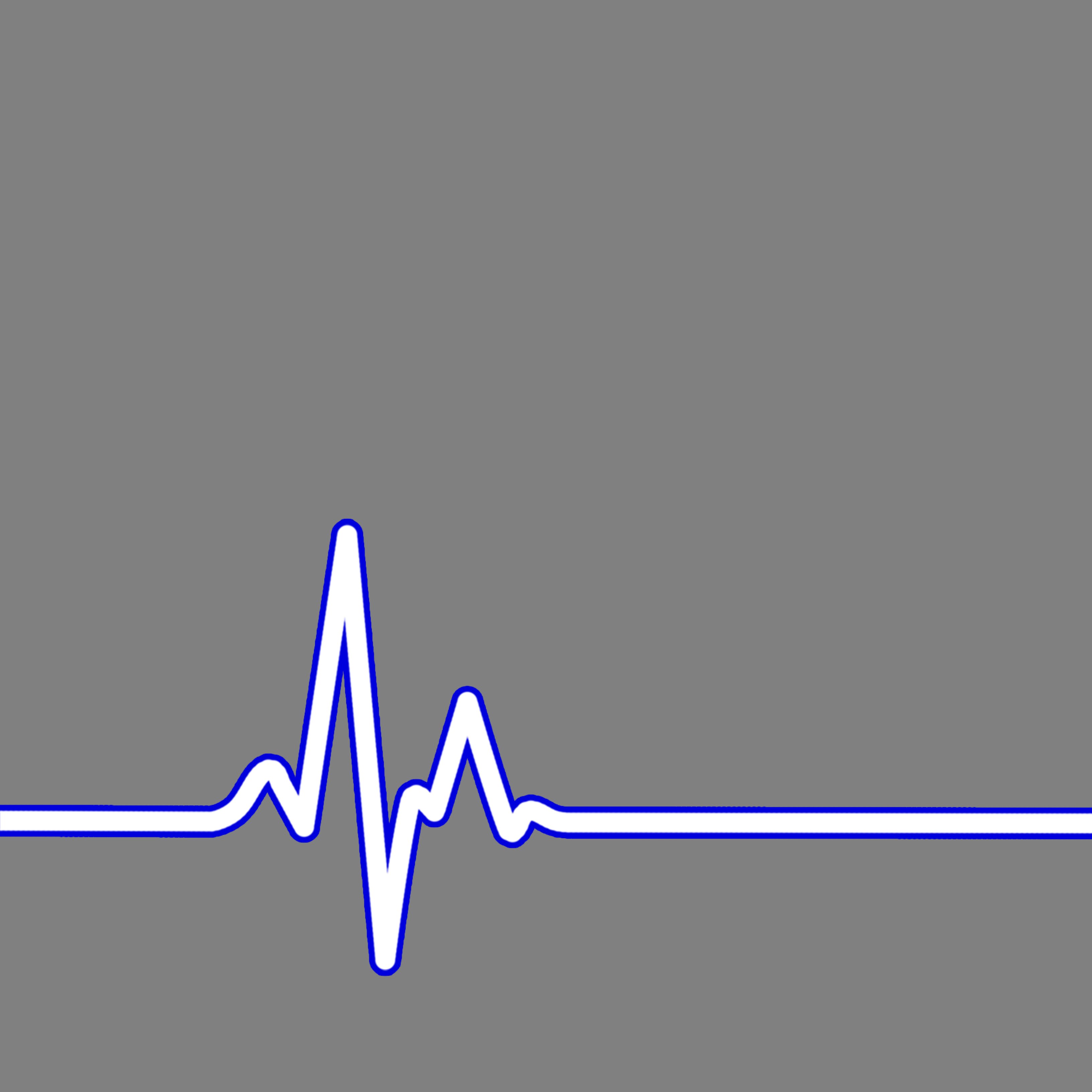 La hipertensió arterial podria causar fibril·lació auricular