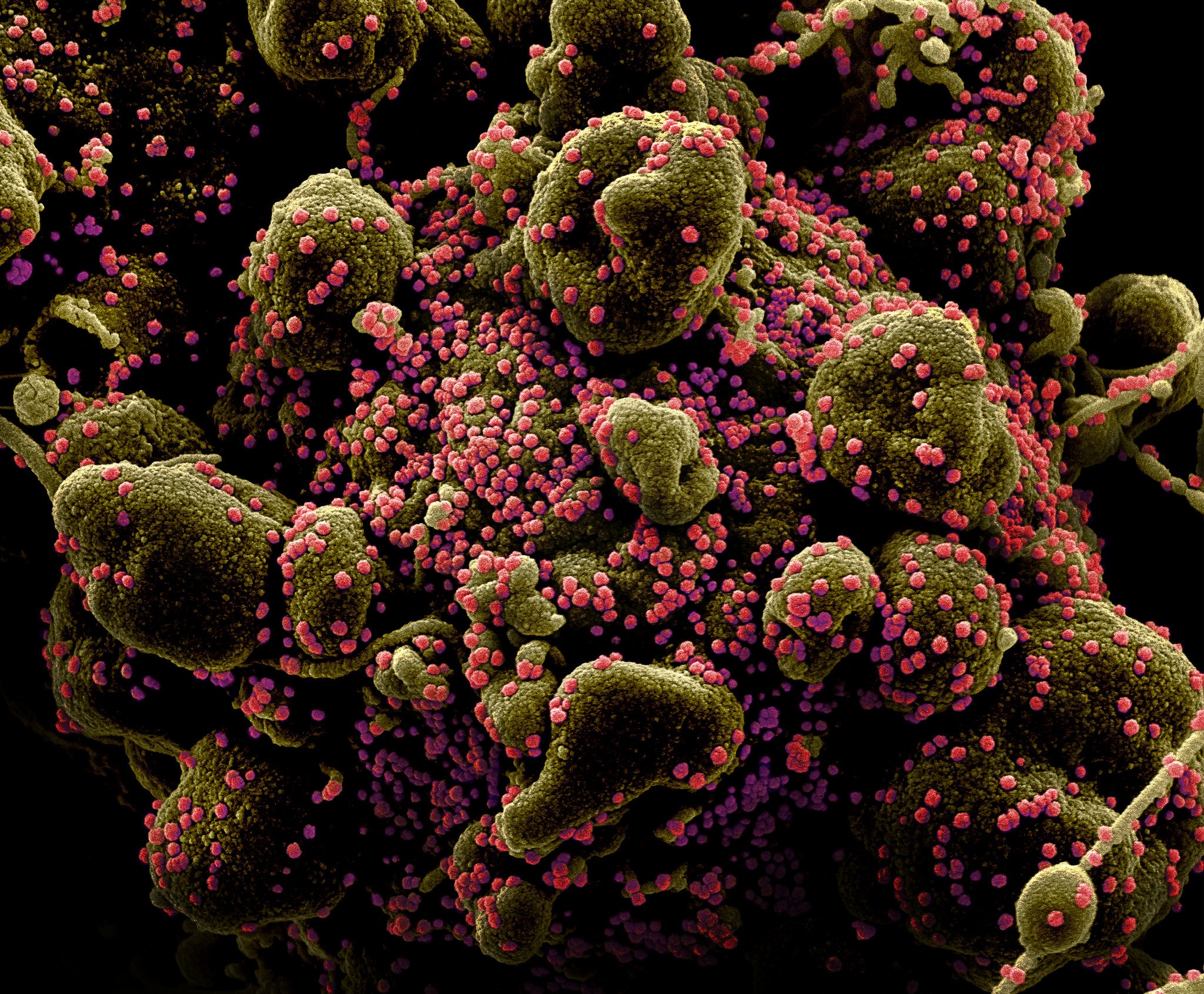 ¿Se acabará el coronavirus este año? La OMS responde