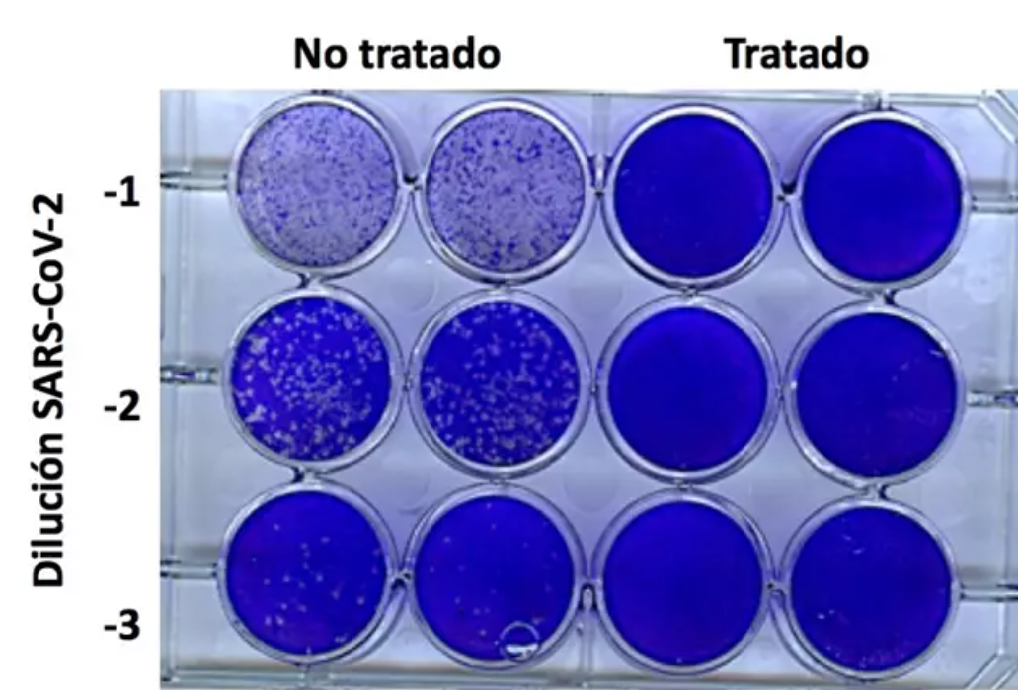 La tecnología UdctFIT elimina la Covid más del 99% en 15 minutos