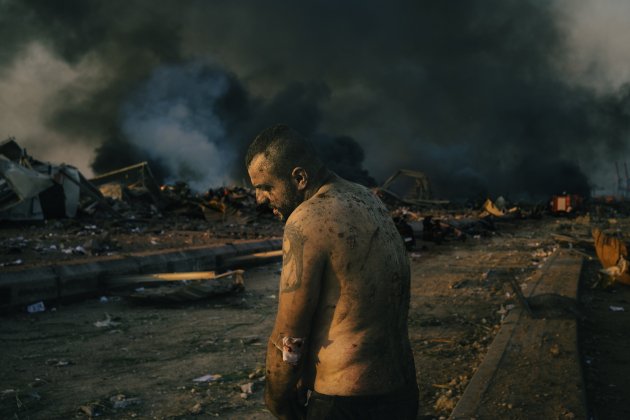 006 World Press Photo of the Year Nominee Lorenzo Tugnoli Contrasto for The Washington Post