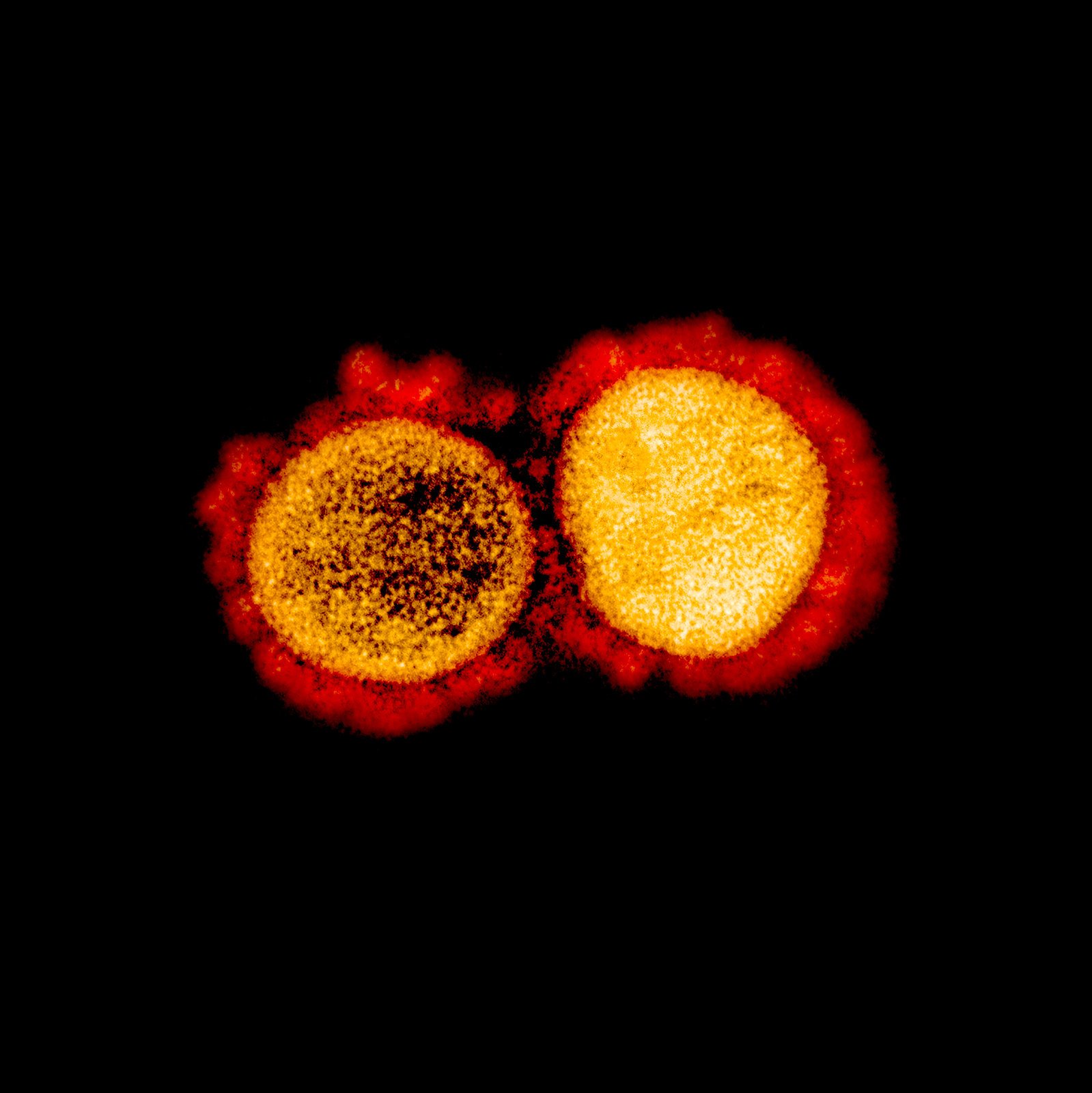 Cuatro cosas sobre el coronavirus que siguen siendo una incógnita