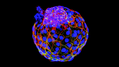 Imagen de i blastoides humanos obtenidos en el laboratorio, similares a embriones humanos de 5 días  Extracto de Yu, et al. Nature (2021)