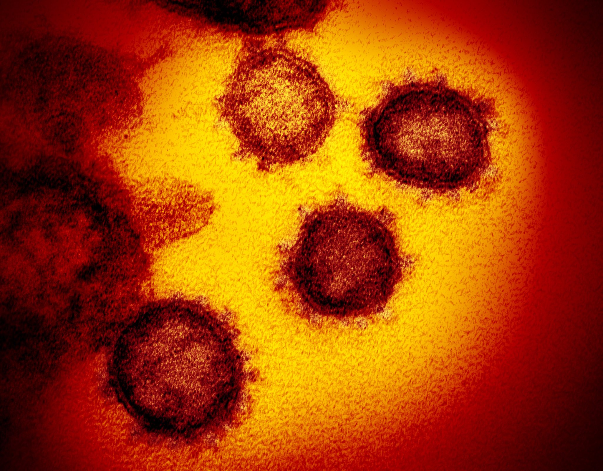 Qué tienen en común un resfriado y el coronavirus, según un estudio
