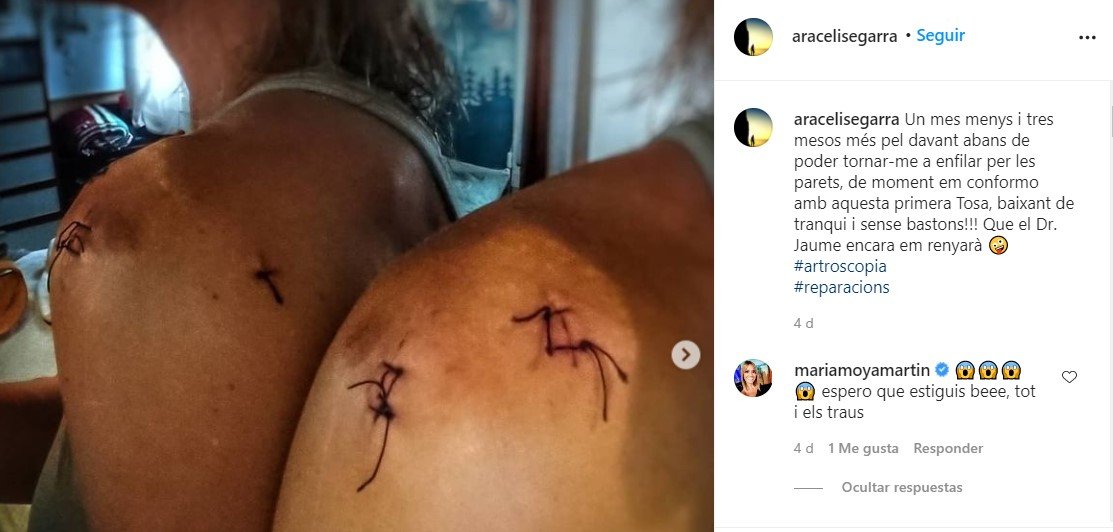 araceli puntos sutura