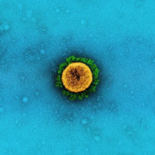 coronavirus celula flickr niaid