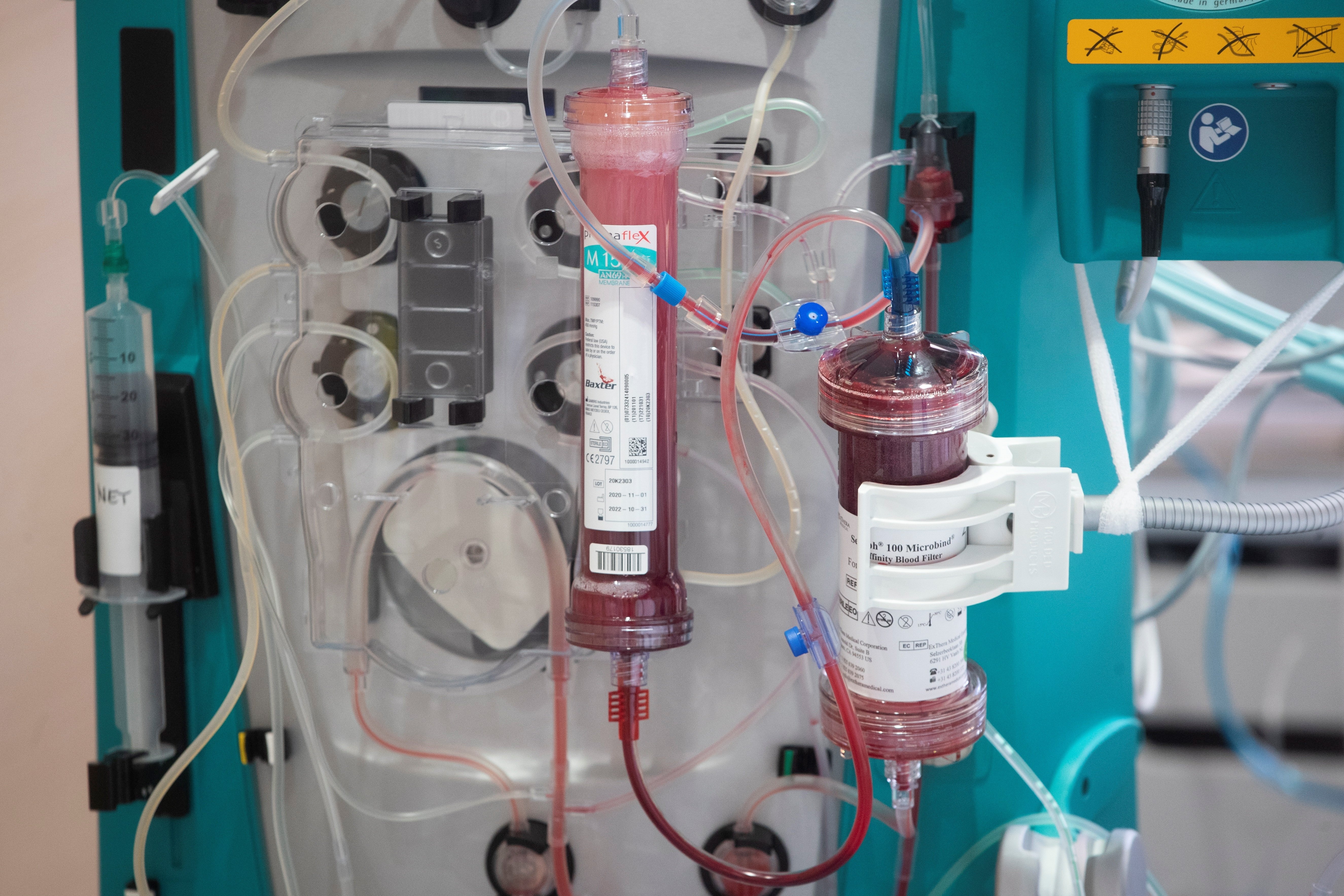 El Vall d'Hebron assaja un filtre de sang per tractar casos greus de Covid