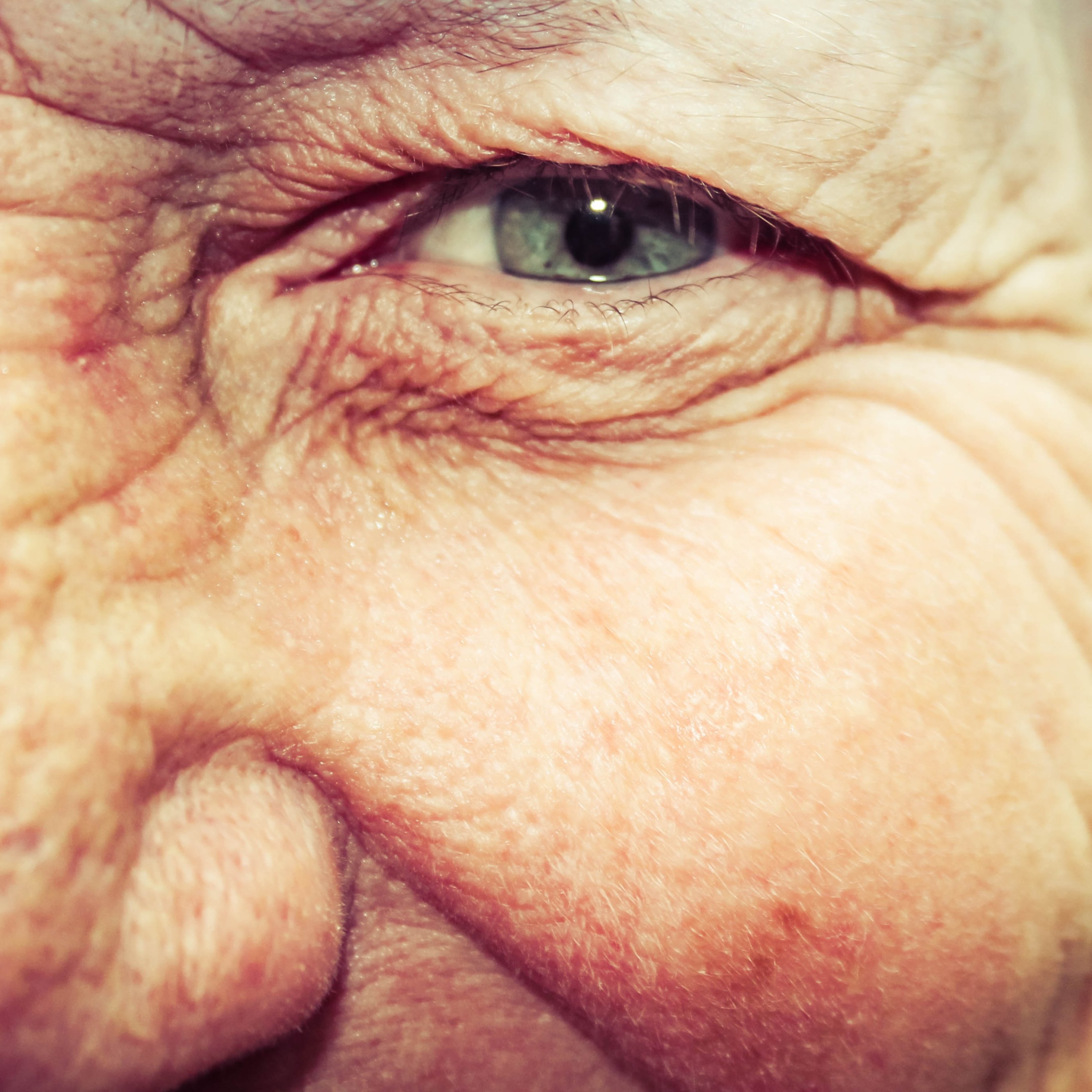 La retina puede ofrecer pistas sobre el Alzheimer