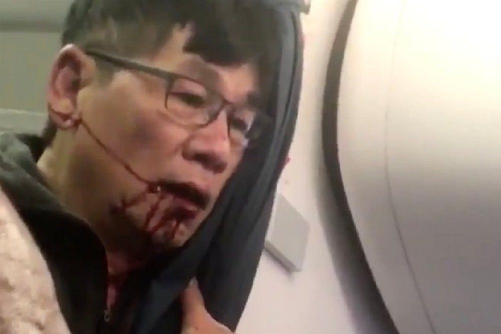 El passatger expulsat del vol de United Airlines denunciarà la companyia