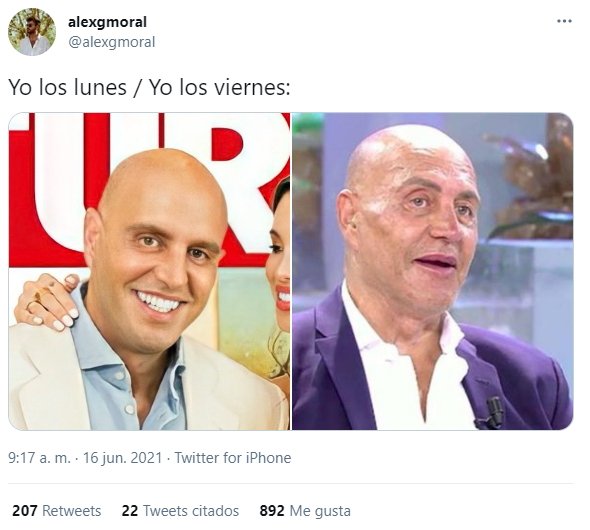 Kiko Matamoros antes y después @alexgmoral