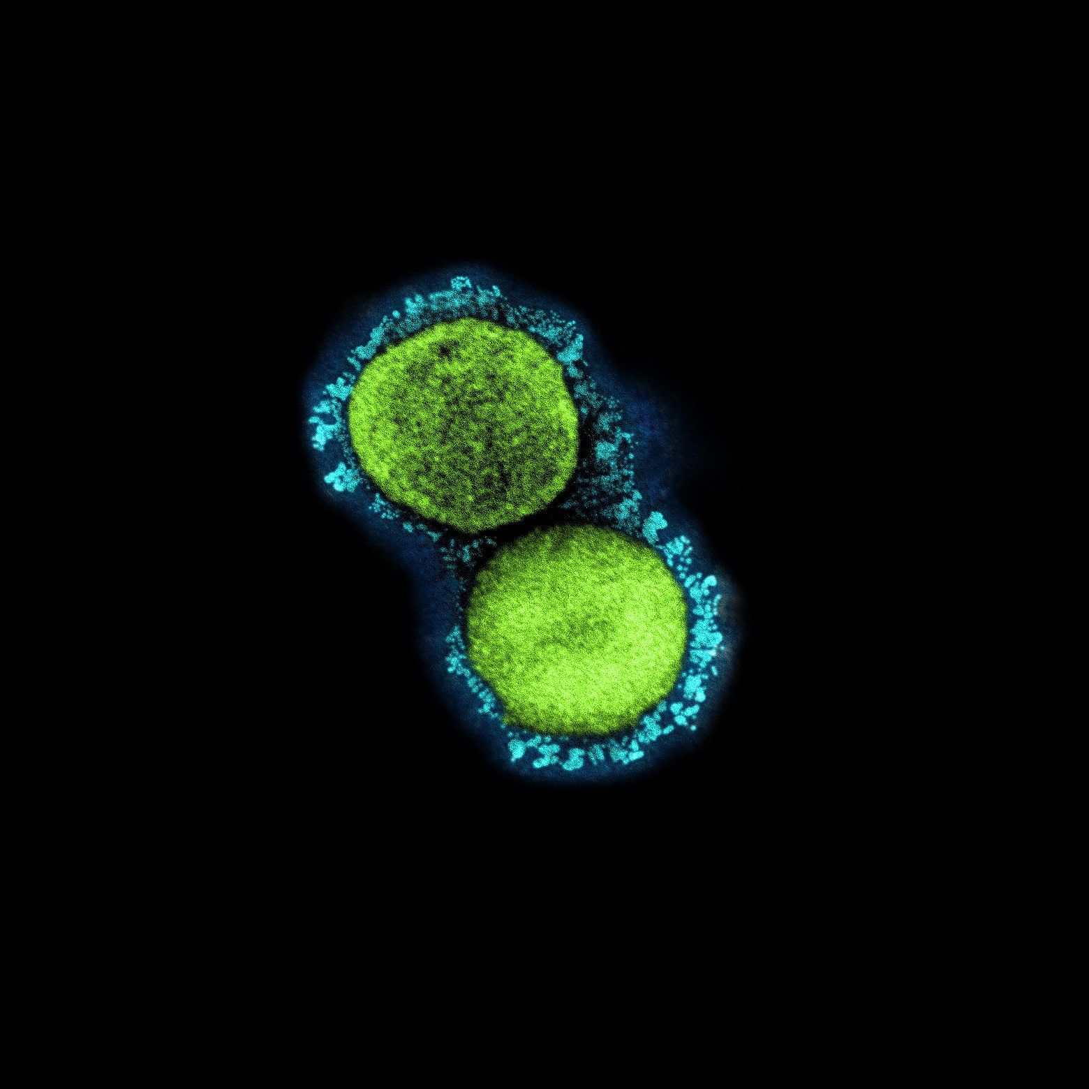 Coronavirus | Variant alfa vs. variant delta: quines diferències hi ha?