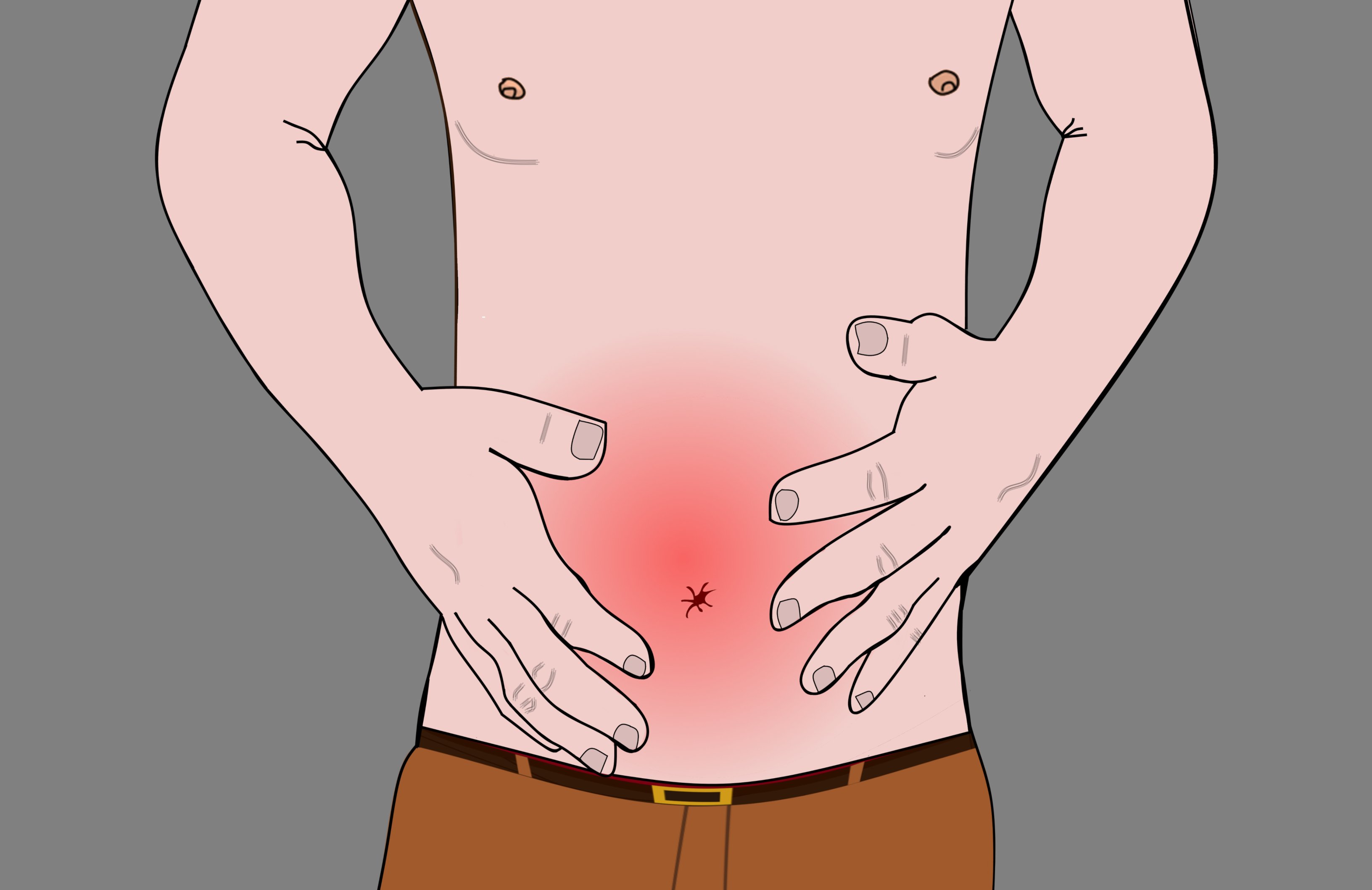 Dolor abdominal