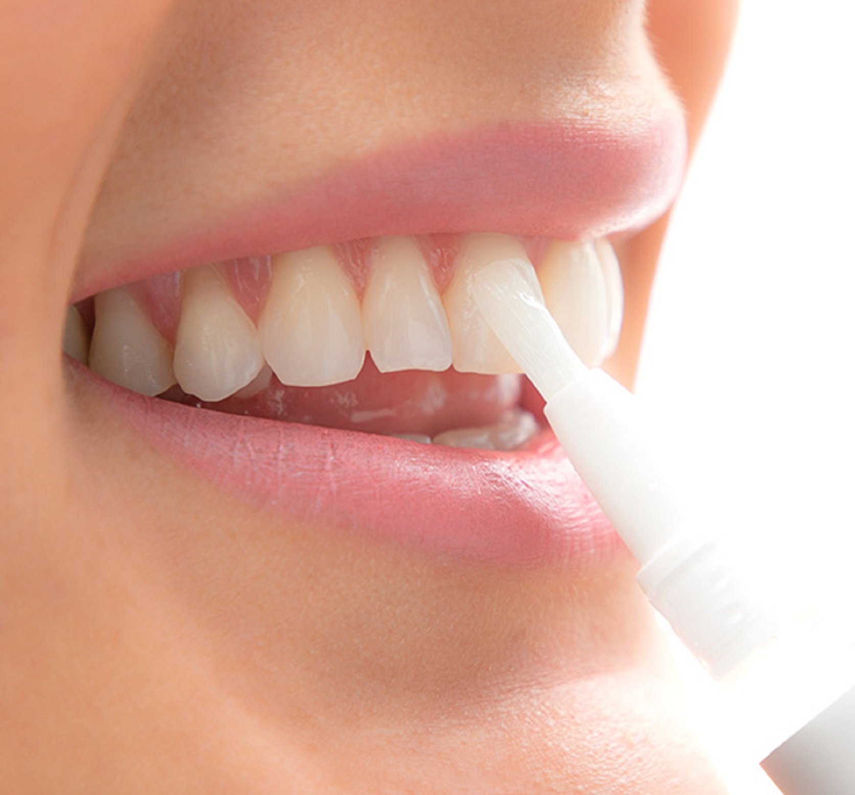 Amazon y Carrefour lanzan un lápiz blanqueador de dientes para la mejor sonrisa