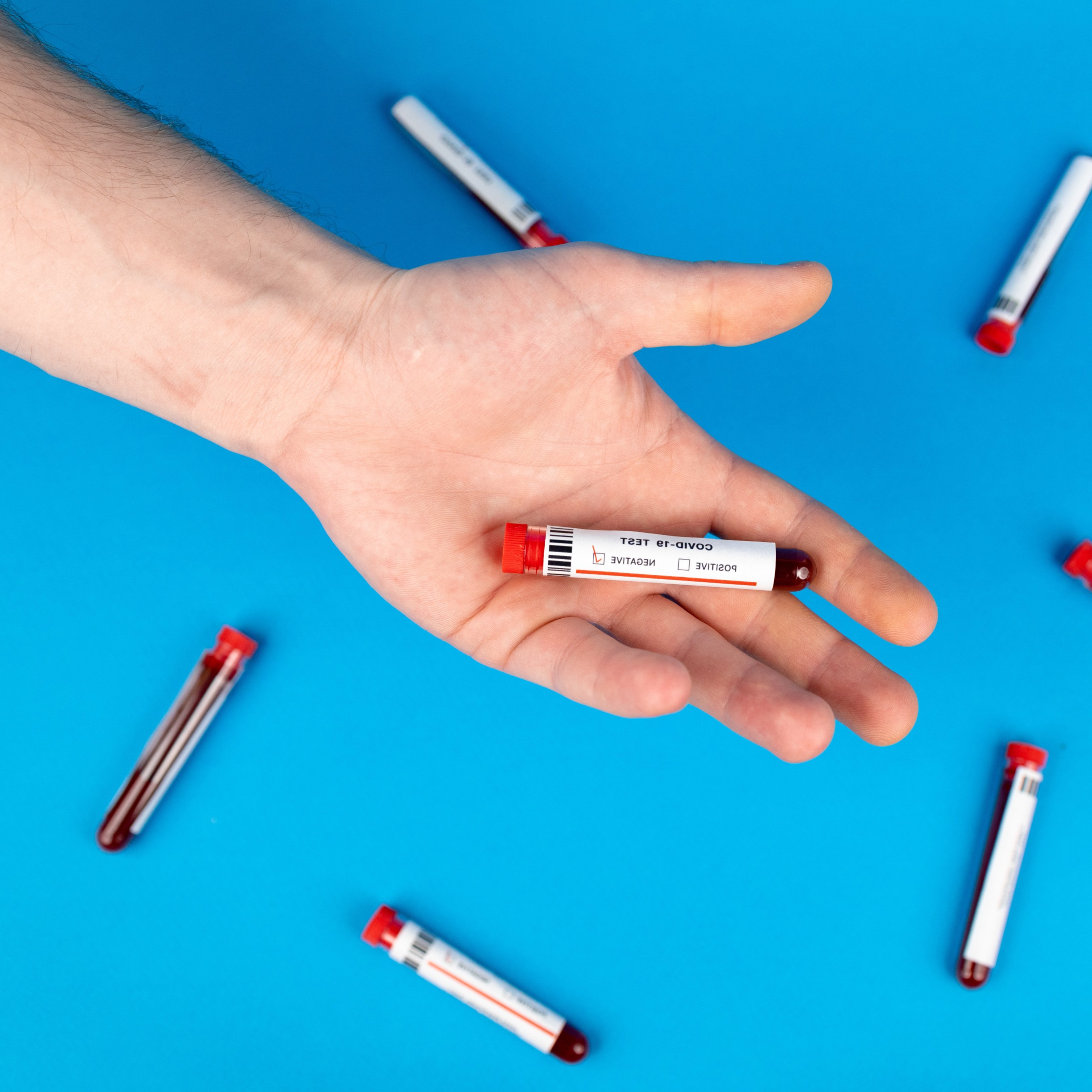 Cómo podemos saber si estamos en una situación de prediabetes