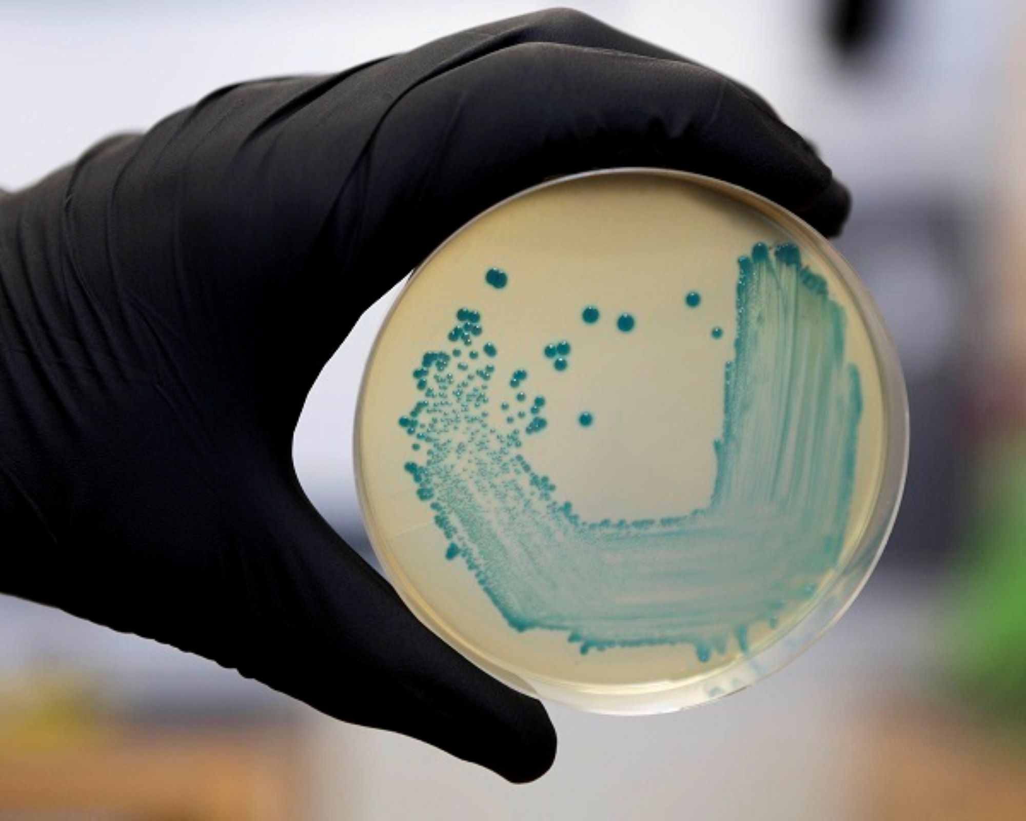 Detectada la presencia de listeria en varios lotes de butifarra