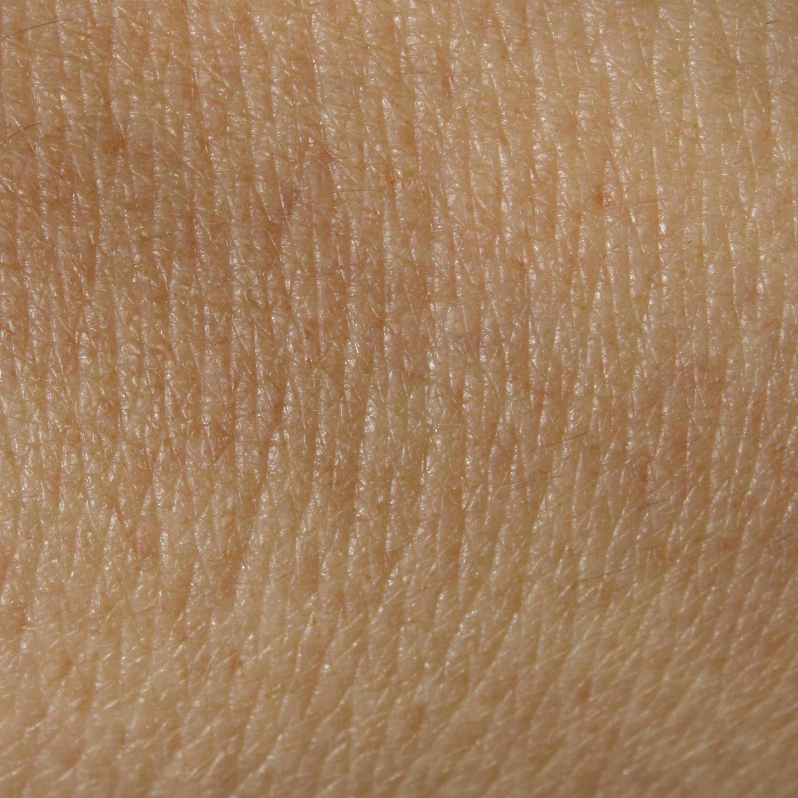Cinc símptomes que mostren que pots tenir la pell "estressada"