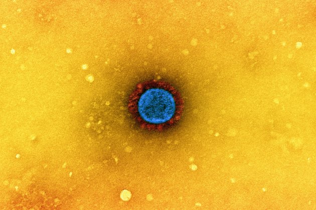 coronavirus sars-cov-2 flickr niaid