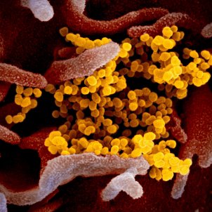 sars-cov-2 coronavirus covid ampliado flickr niaid
