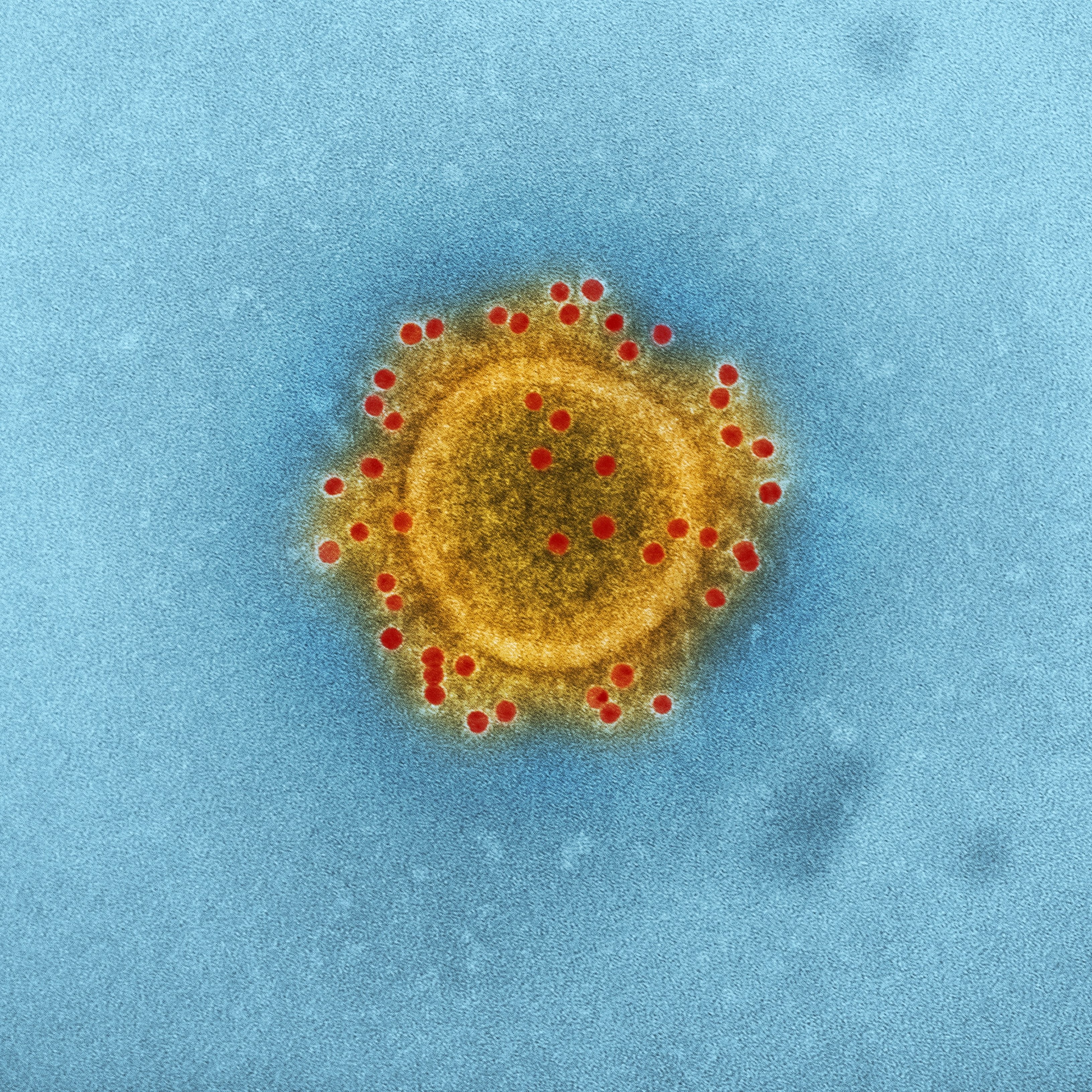 Dues noves variants del coronavirus que preocupen la comunitat científica