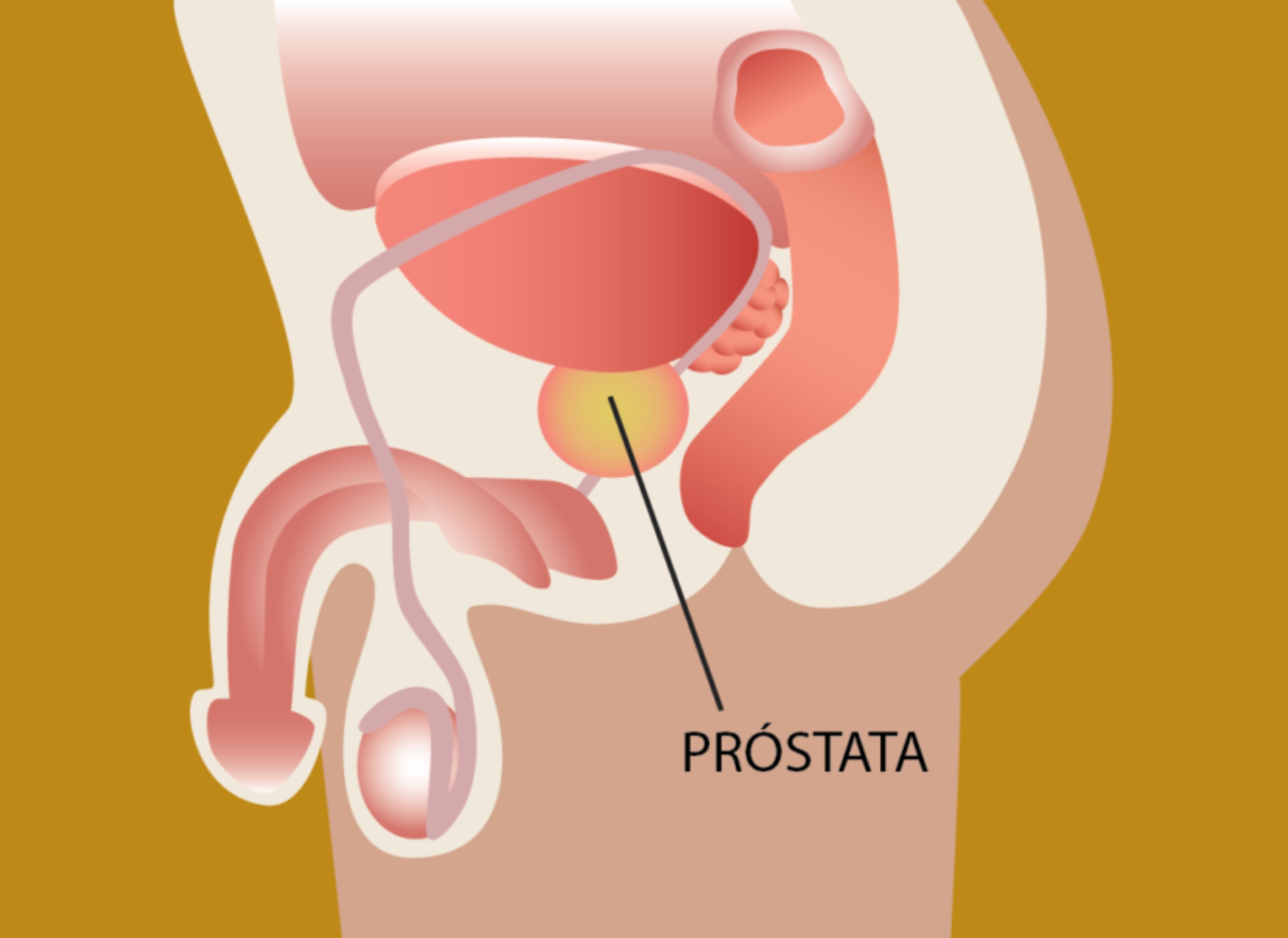 Gráfico próstata