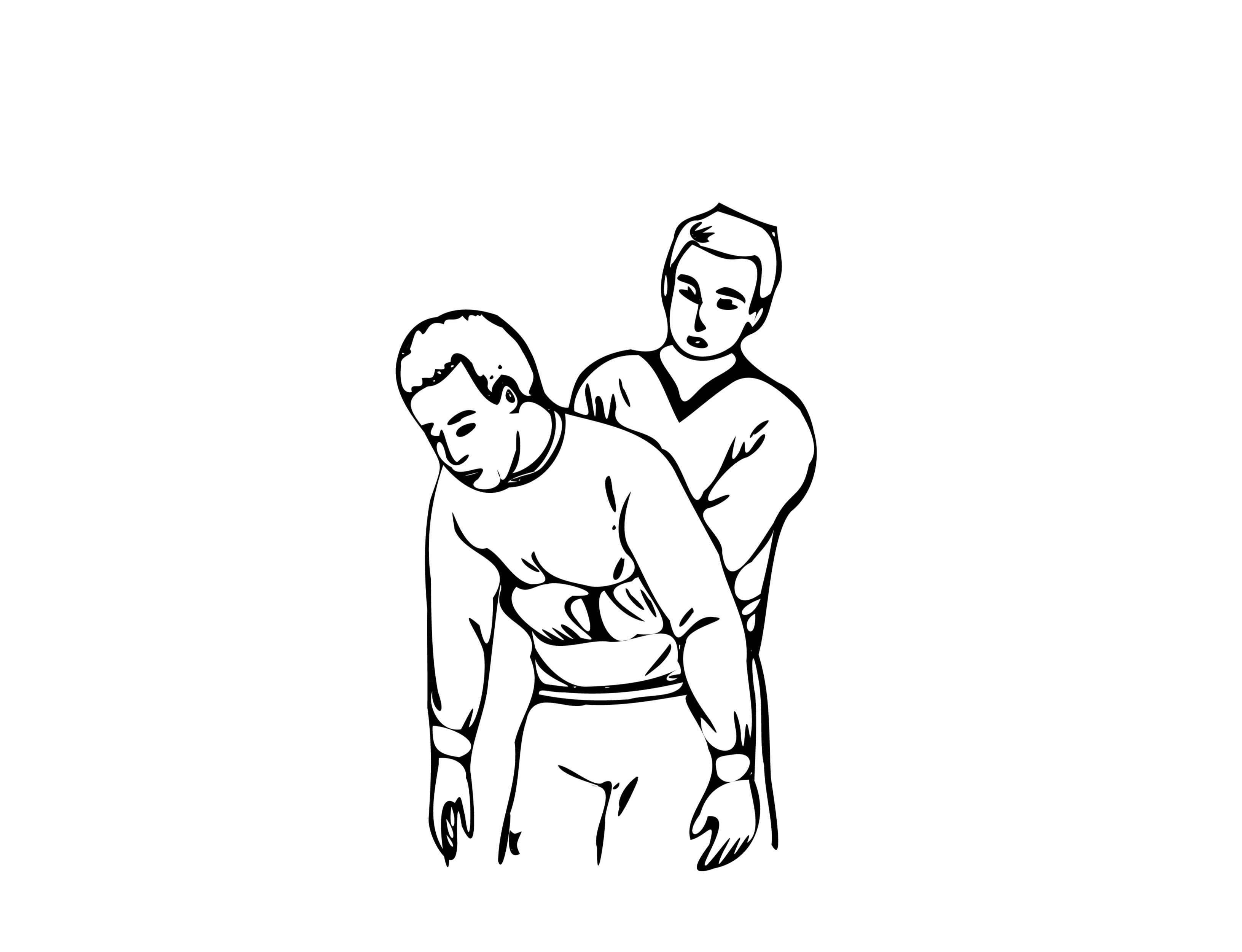 Maniobra de Heimlich