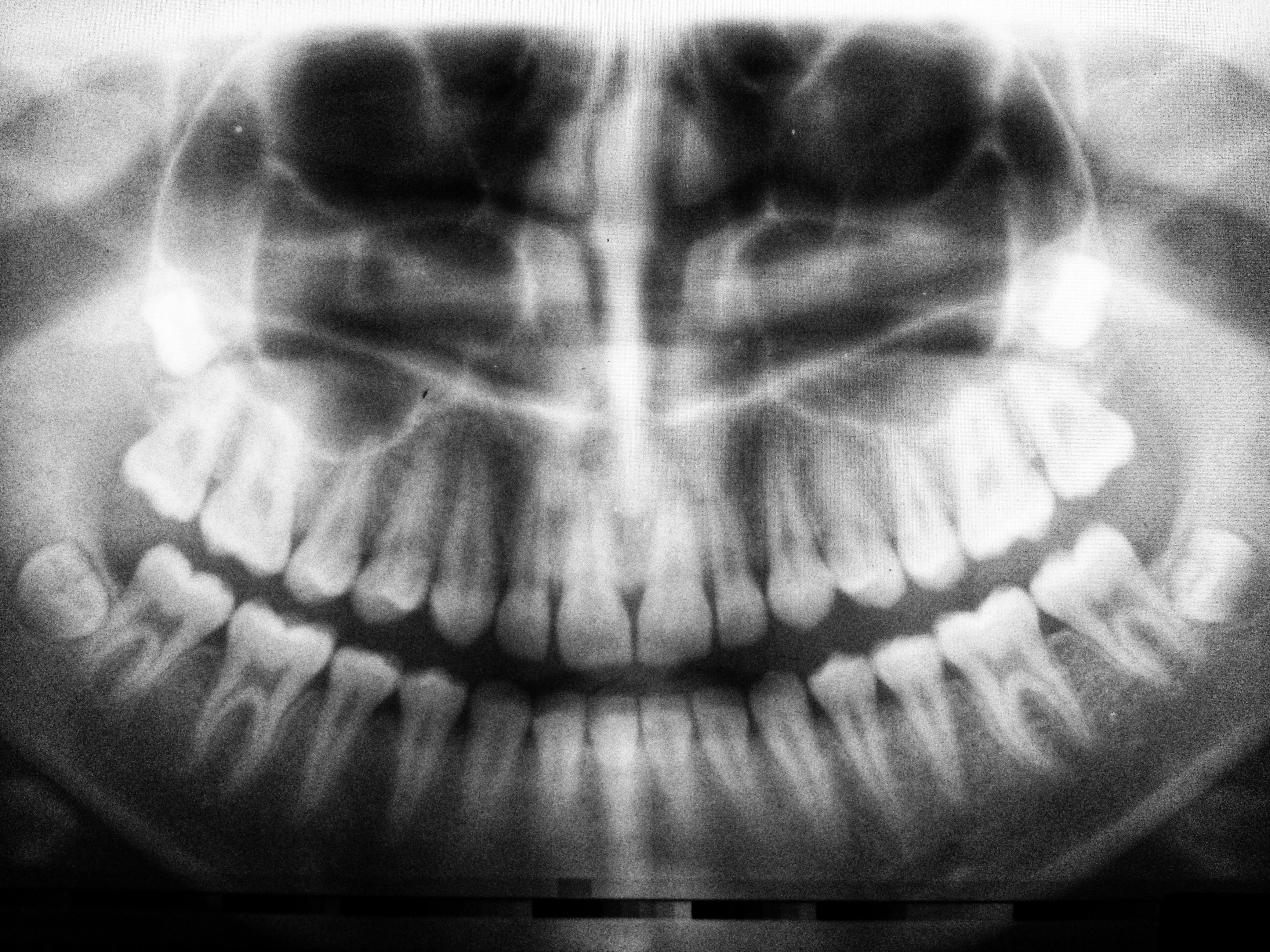Radiografía dental Unsplash