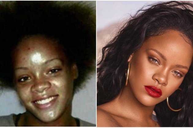 Abans i després de Rihanna