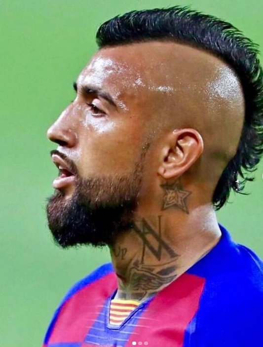 arturo vidal nbarça2