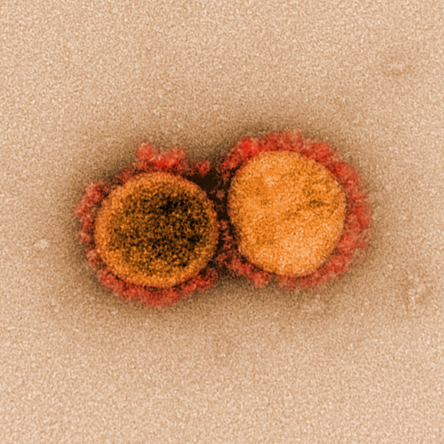 Variante delta plus del coronavirus: todo lo que se sabe hasta ahora