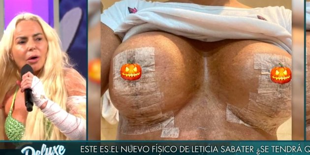 leticia zapatero operacion pechos t5